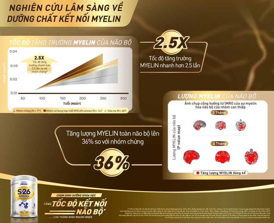 Tăng cường trí nhớ cho học sinh nhờ kết nối não bộ trong giai đoạn vàng (0-2 tuổi) hiệu quả là nền tảng phát triển trí não của con